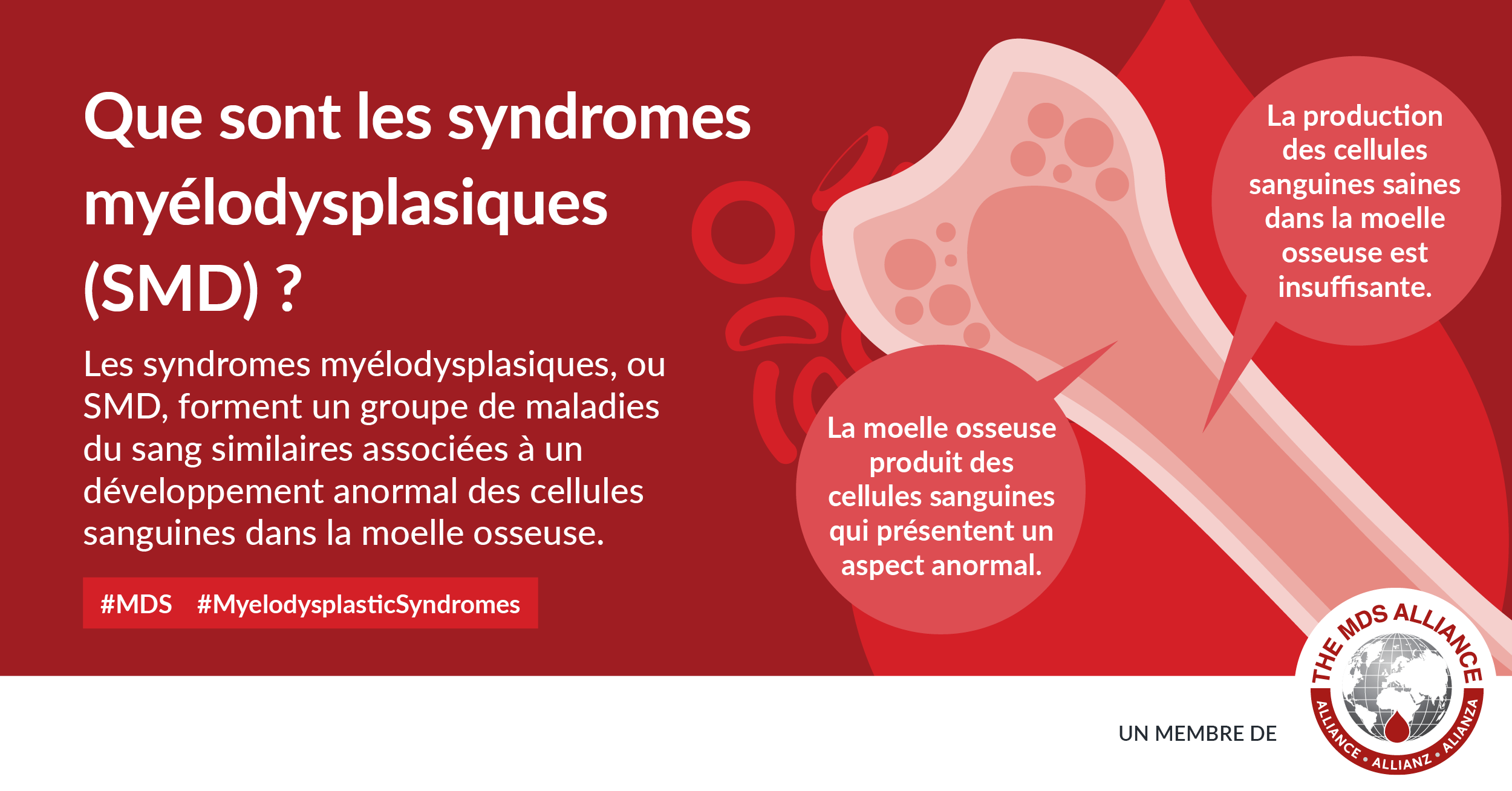 10 questions sur les myélodysplasies